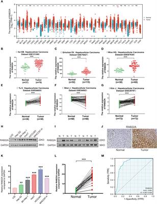 Characterization of prognostic value and immunological roles of RAB22A in hepatocellular carcinoma